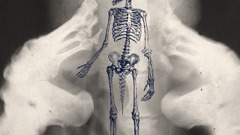 drawing x-rays Ambient Bones